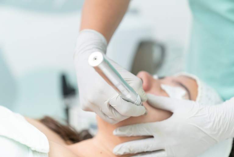 Is Laser Skin Resurfacing Really Worth it? Discover Why