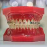 5 Innovative Methods Changing Teeth Alignment Fast