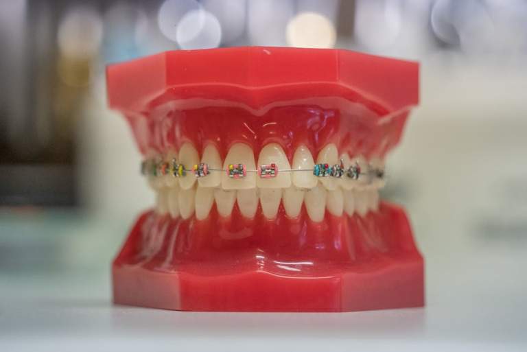 5 Innovative Methods Changing Teeth Alignment Fast